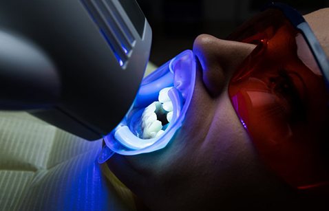 Close up of patient receiving in-office teeth whitening